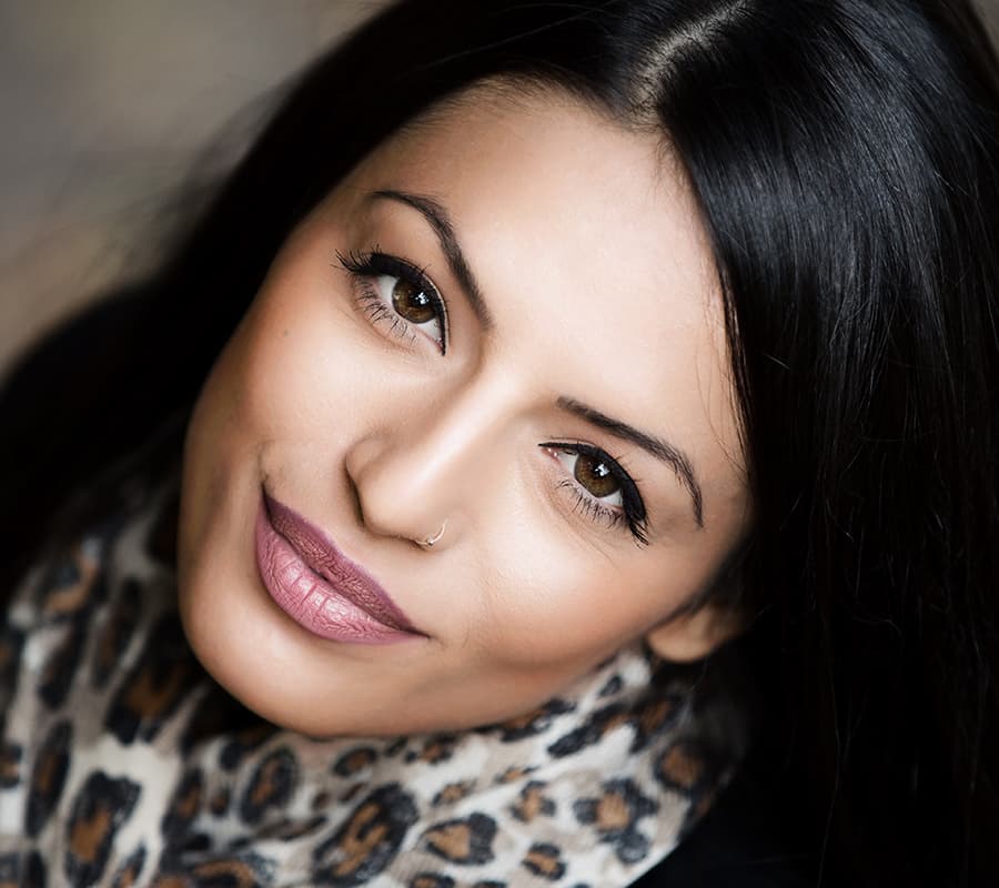 Augmentation des lèvres par acide hyaluronique